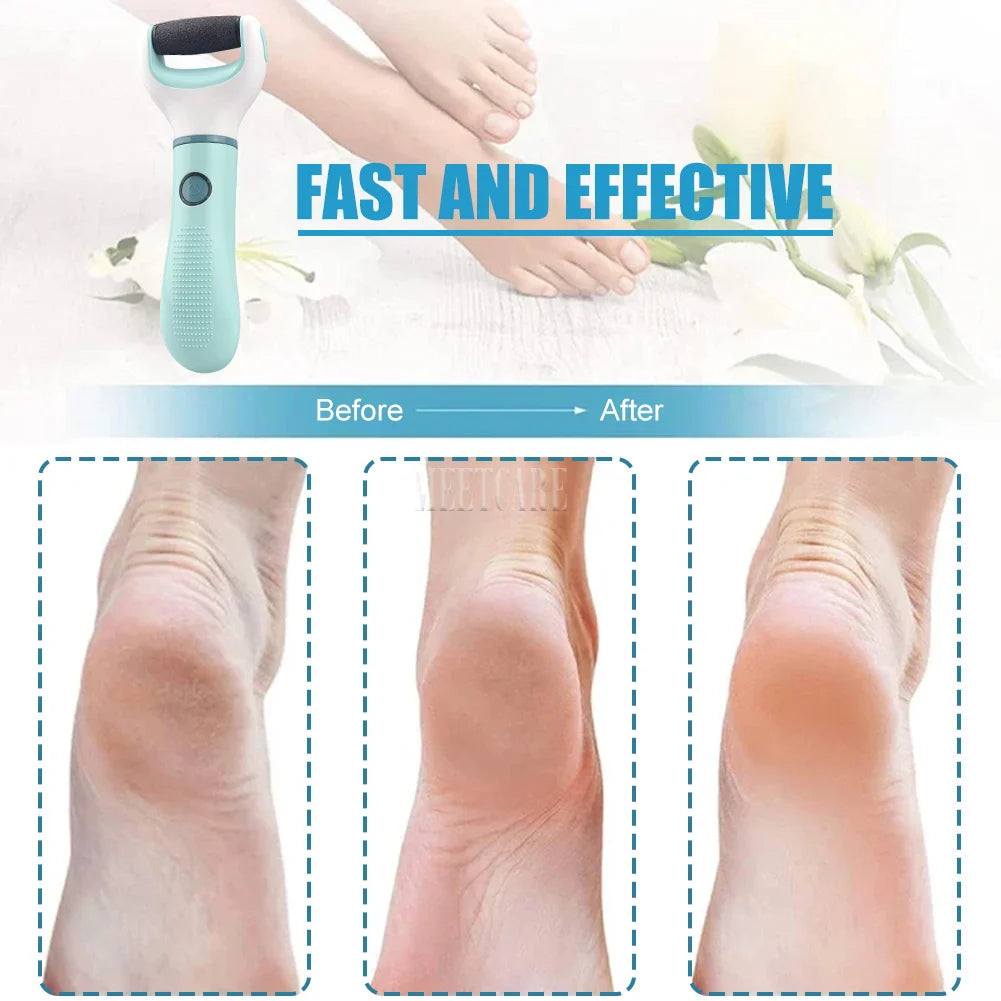 Dead Skin Electric Foot Grinder  Pedicure Tool