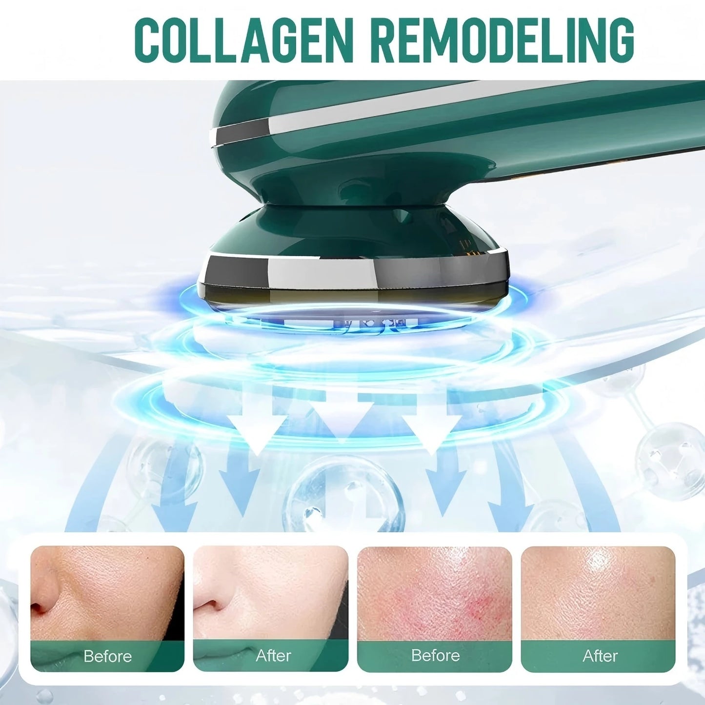Face Lifting Machine Neck Skin Tighten Massager